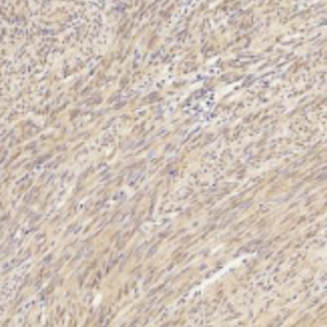 (Bioenzy)HSP27 Polyclonal Antibody