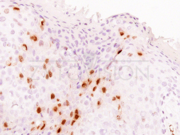 ZYTOFAST PLUSH CISH Implementation Kit HRP-DAB - Image 2